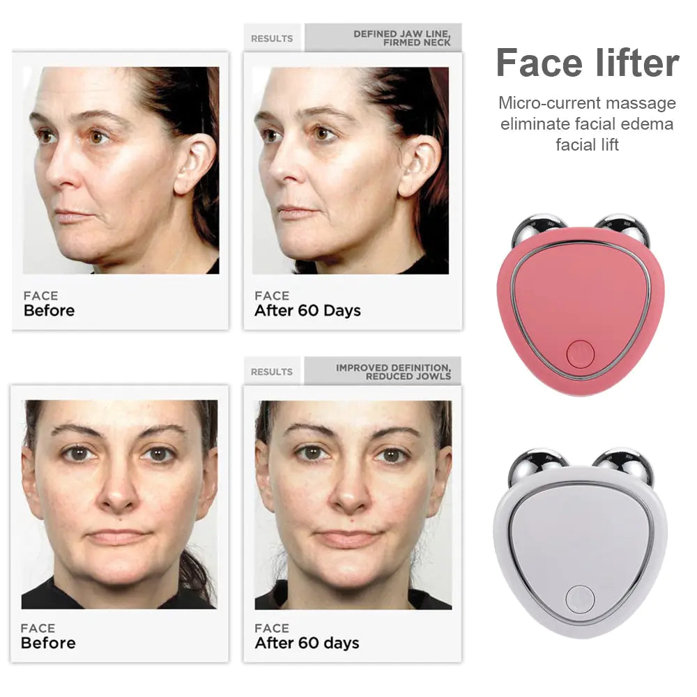 Facial Lifting