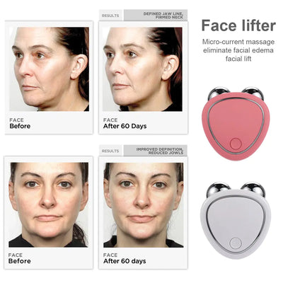 Facial Lifting