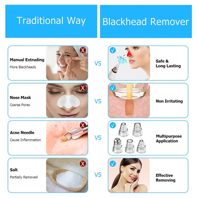 Electric Blackhead Remover