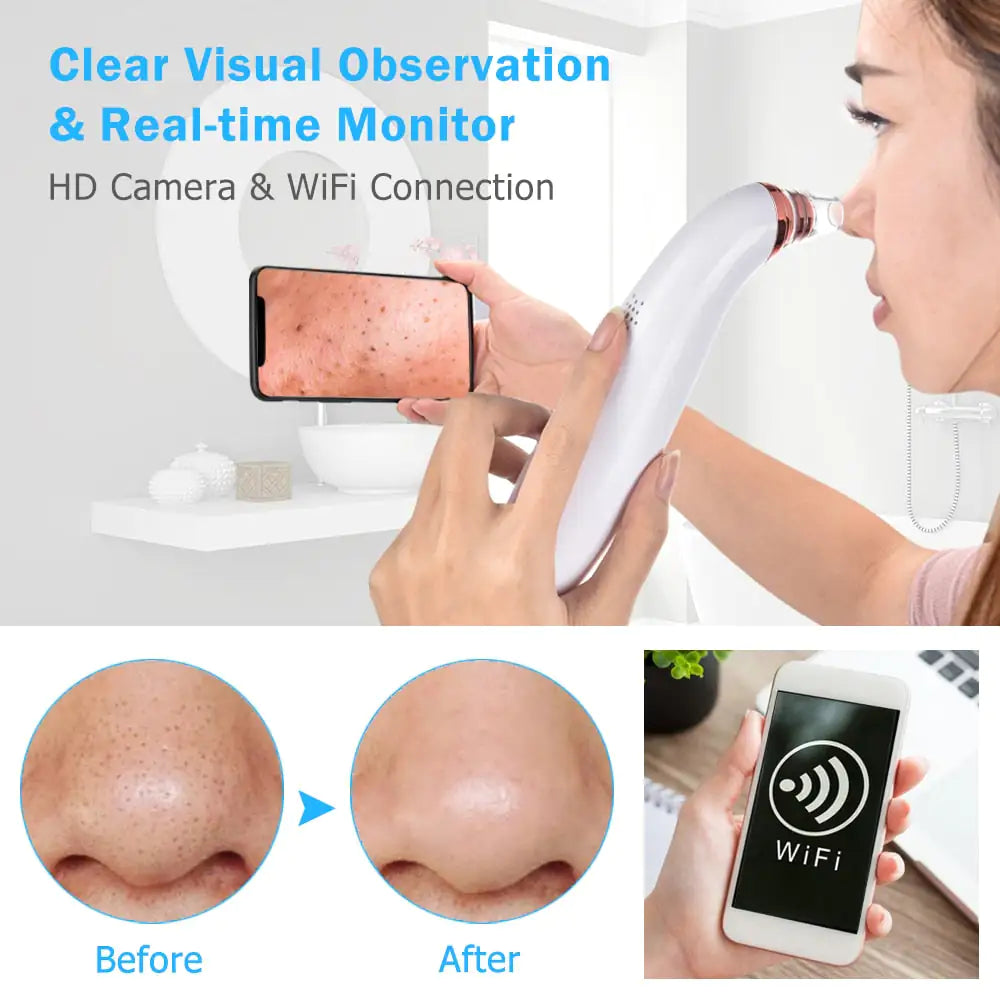 Electric Blackhead Remover