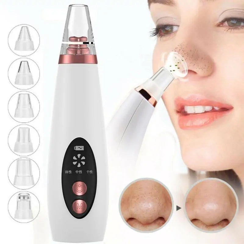 Rechargeable Blackhead Remover