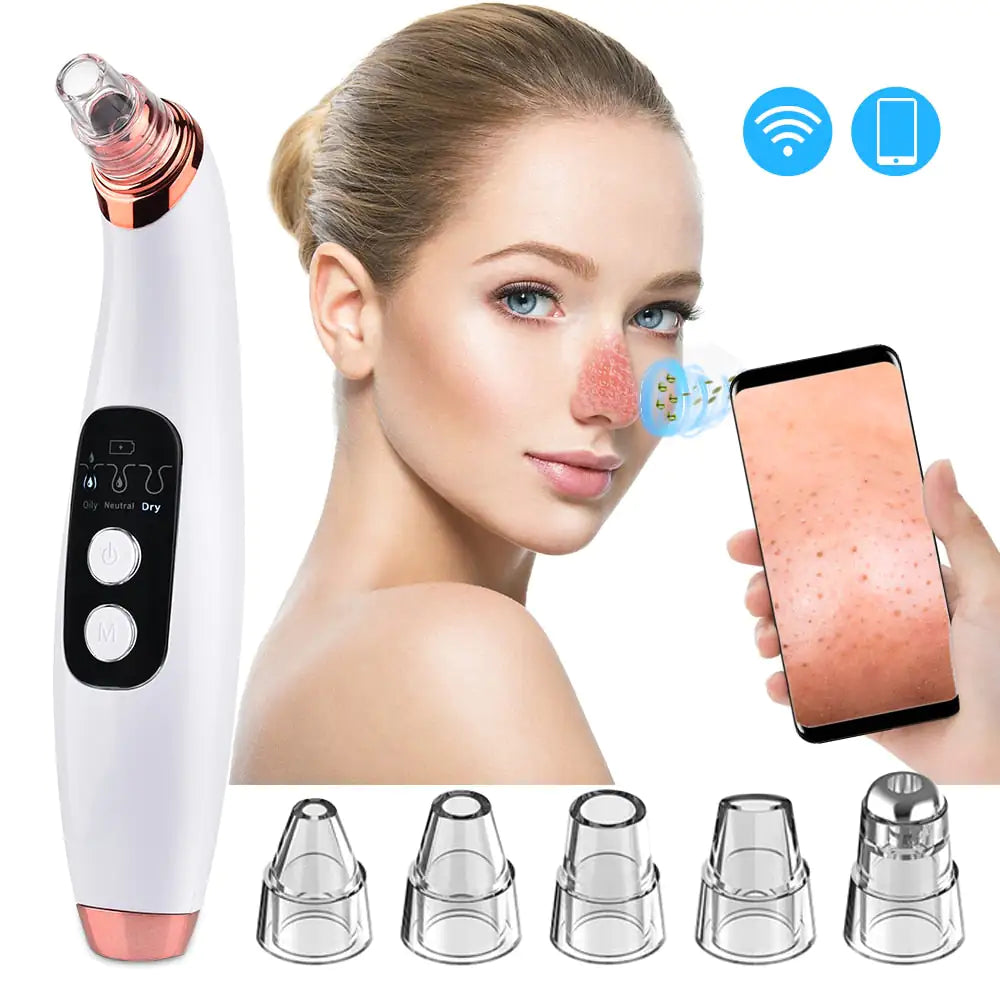 Electric Blackhead Remover