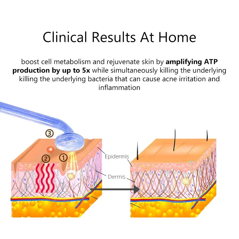 High Frequency Electrotherapy