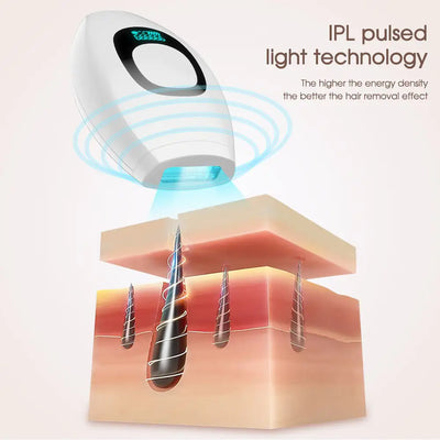 IPL Laser