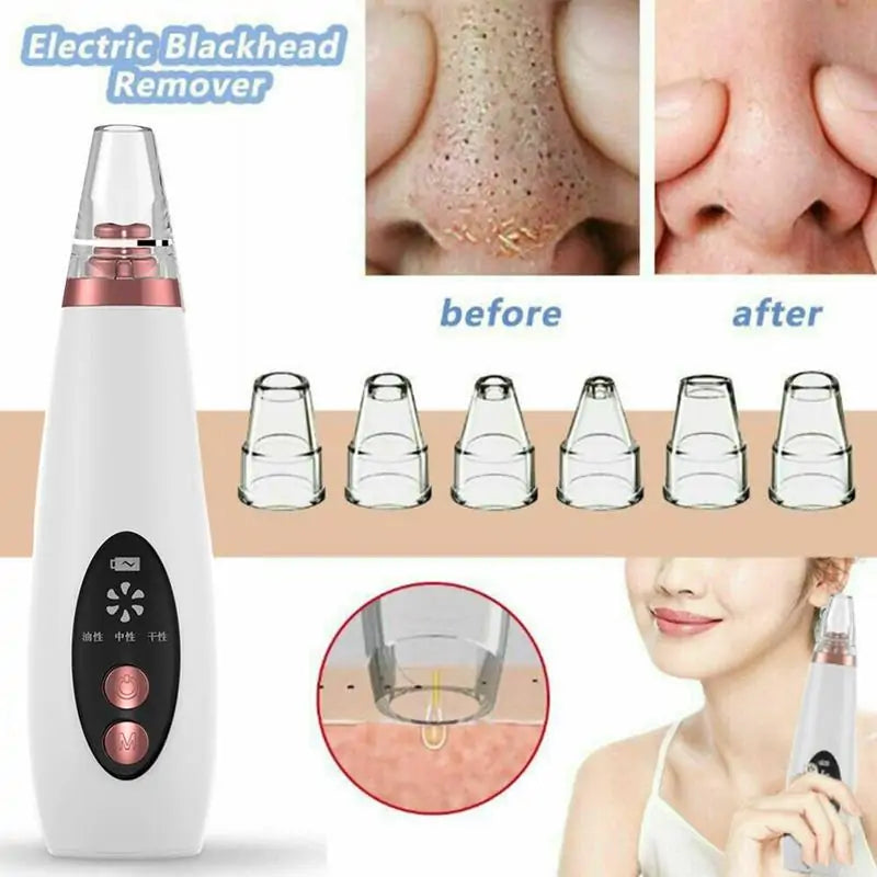 Rechargeable Blackhead Remover